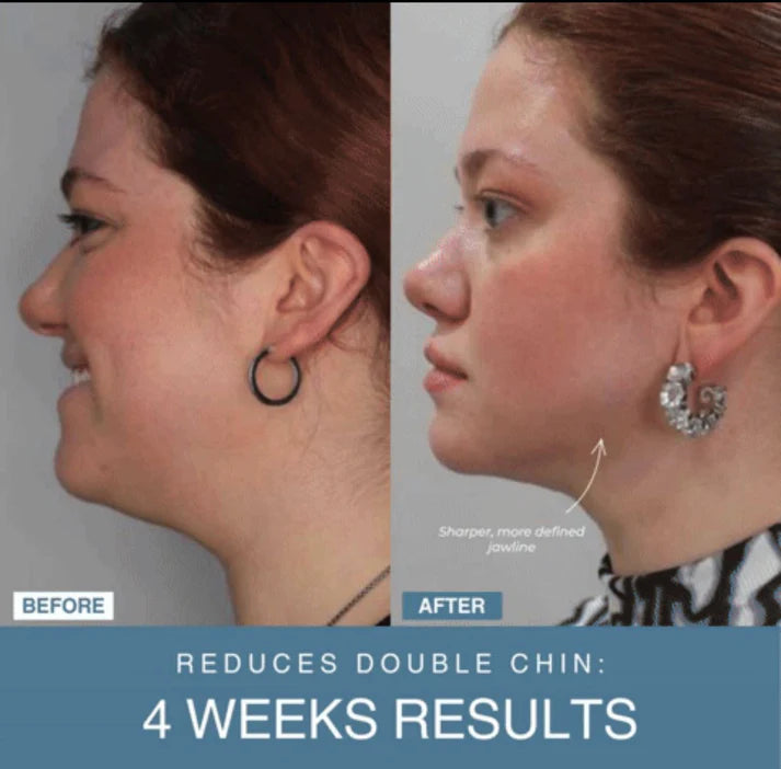 Zeenah™ 7-in-1 LED Anti-Aging/Wrinkle Apparatus