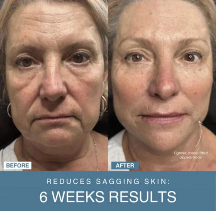 Zeenah™ 7-in-1 LED Anti-Aging/Wrinkle Apparatus